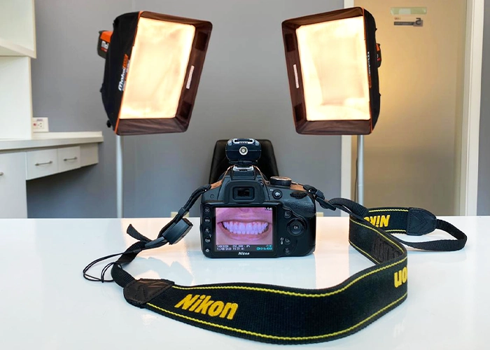 Ambiente da Clínica IEM: sala de documentação fotográfica com câmera profissional exibindo o sorriso de uma paciente entre dois refletores