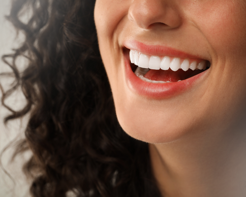 Close de sorriso feminino com dentes brancos e alinhados após tratamento estético
