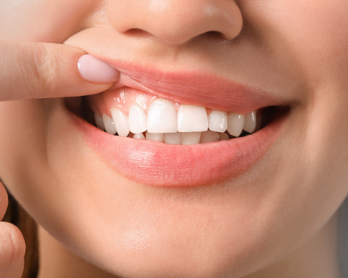 Close de sorriso com gengivas saudáveis