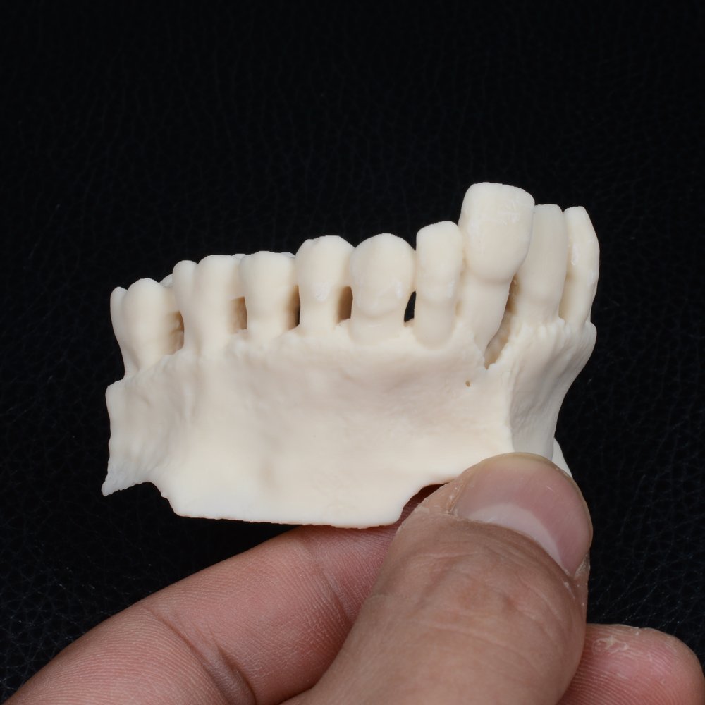 Modelo ósseo de maxila impresso em 3D para planejamento reverso de implantes