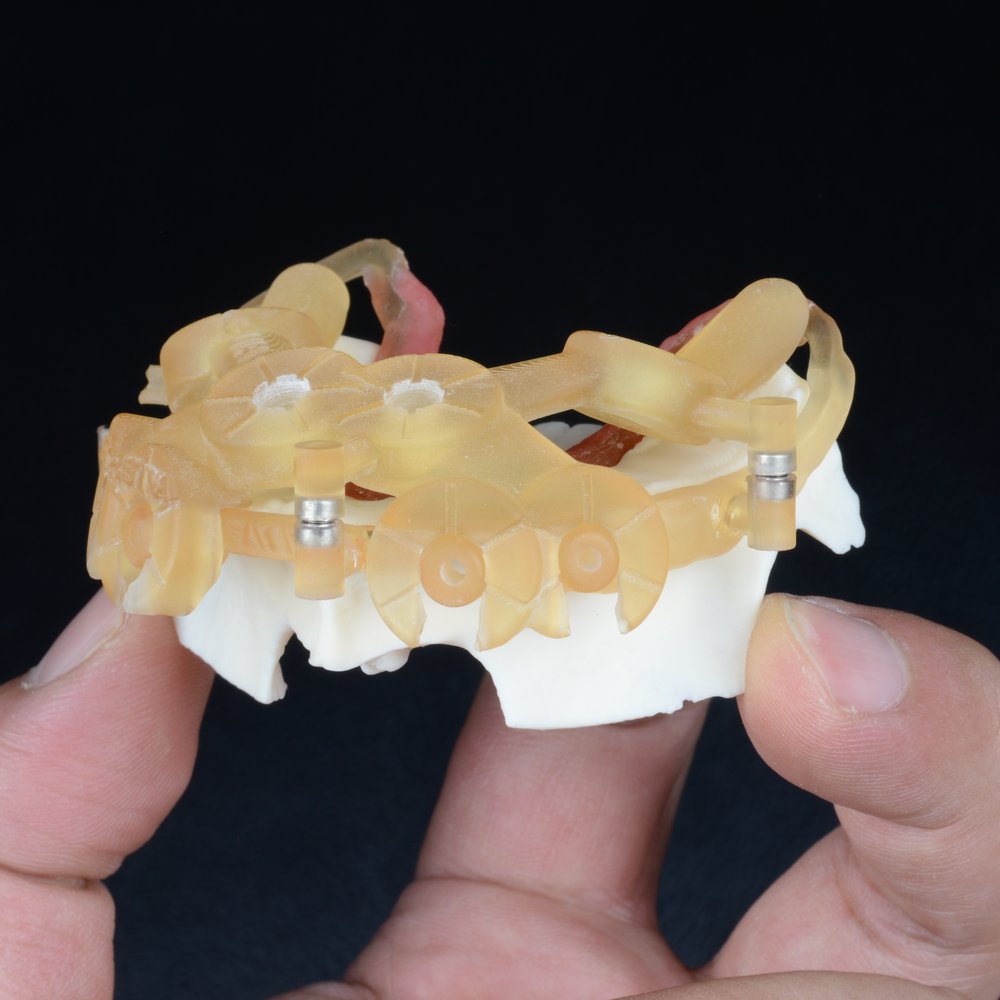 Guia cirúrgico multicomponente com pinos de fixação sobre modelo impresso em 3D — cirurgia guiada